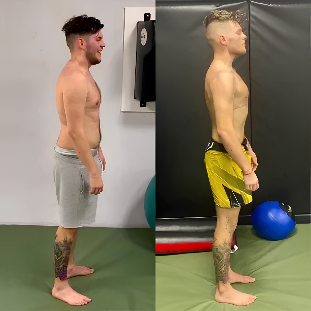 Nervadic Instant Posture Corrector™