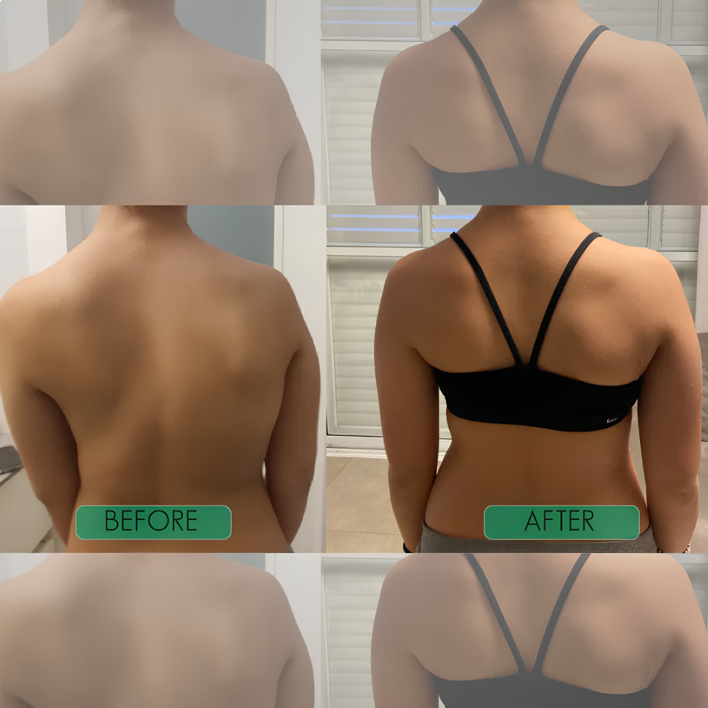 Nervadic Instant Posture Corrector™