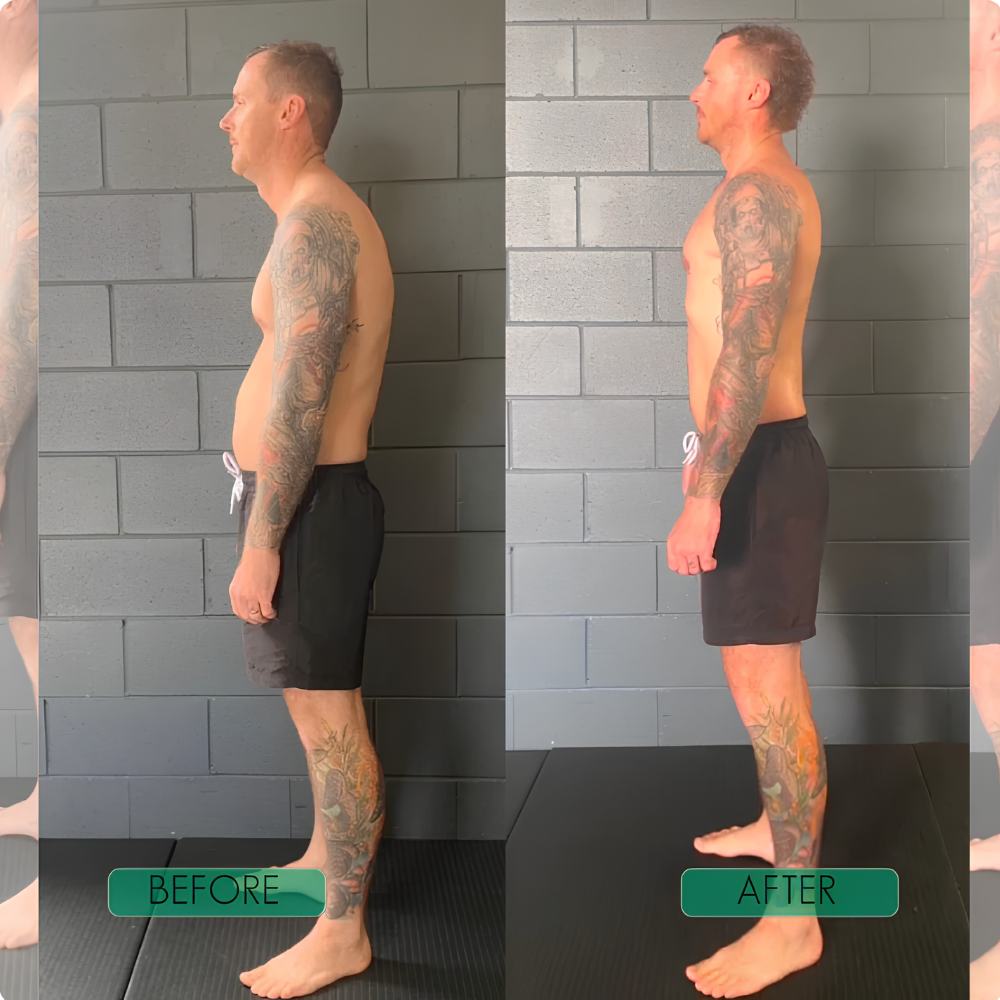 Nervadic Instant Posture Corrector™
