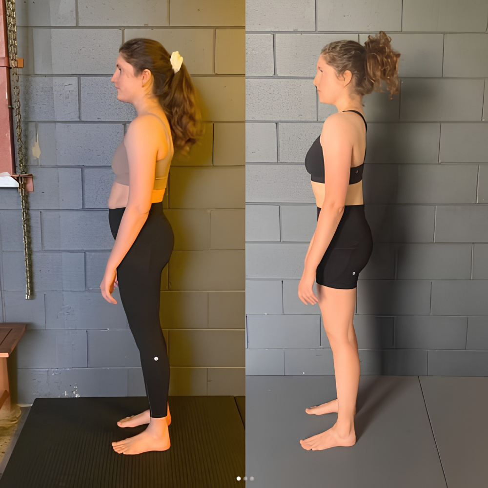 Nervadic Instant Posture Corrector™